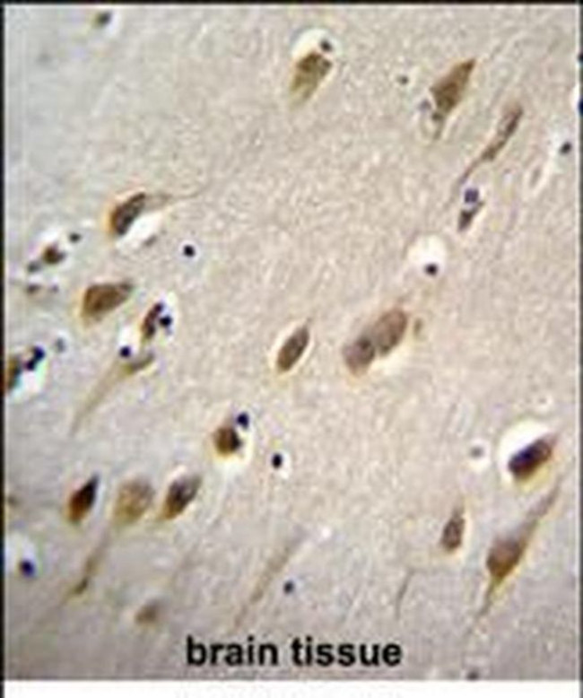 HARBI1 Antibody in Immunohistochemistry (Paraffin) (IHC (P))