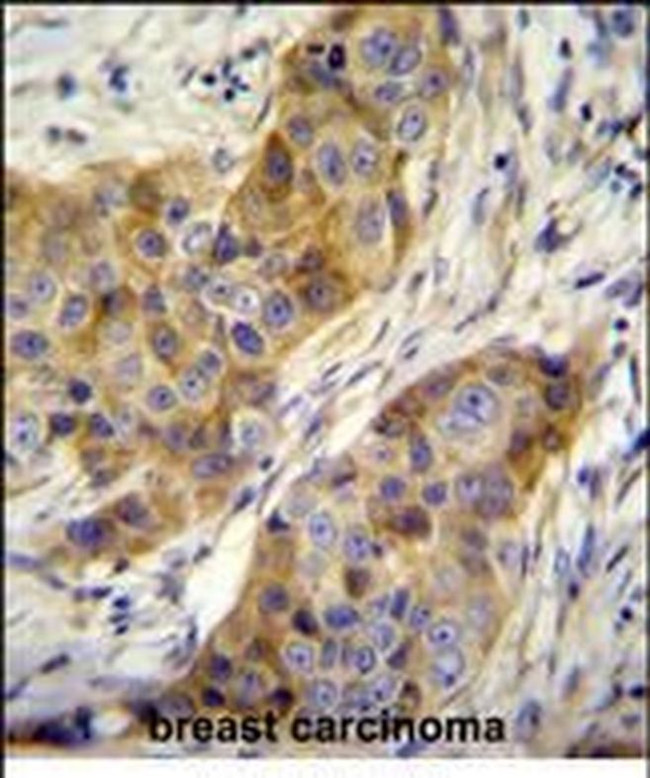 ANKRD39 Antibody in Immunohistochemistry (Paraffin) (IHC (P))