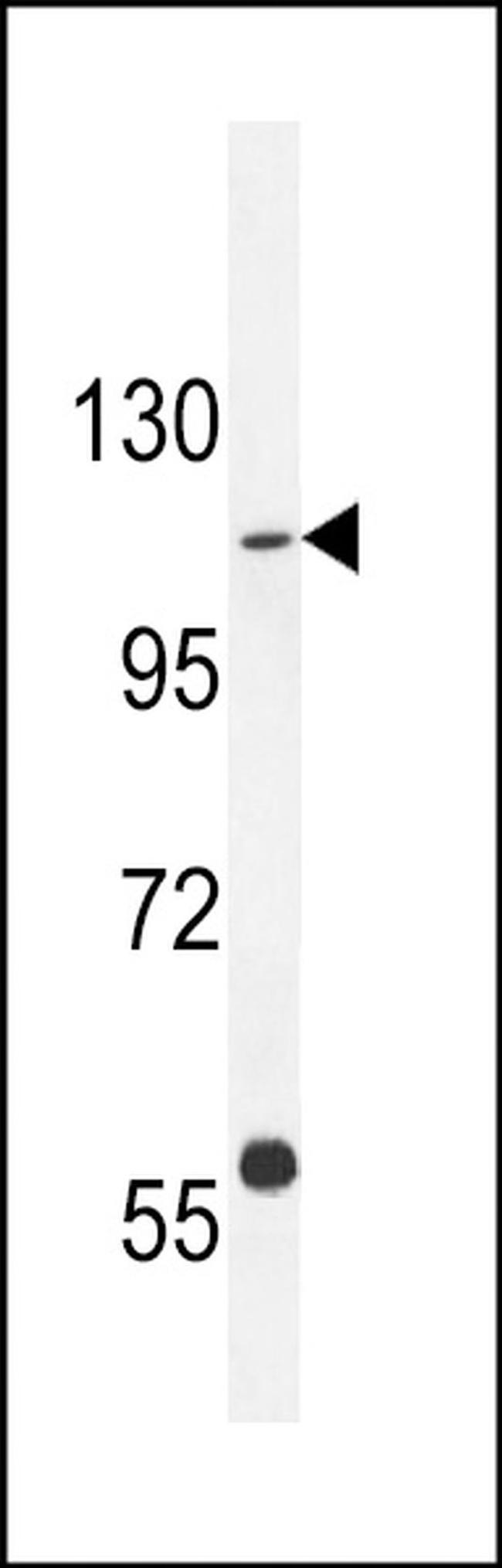 GIGYF1 Antibody in Western Blot (WB)
