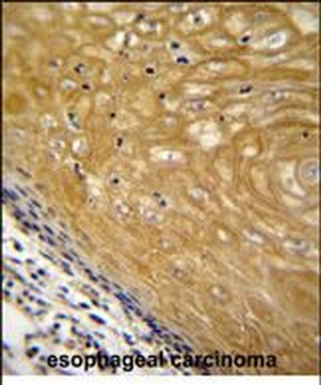 NUDT22 Antibody in Immunohistochemistry (Paraffin) (IHC (P))