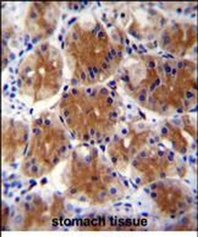 ABHD17C Antibody in Immunohistochemistry (Paraffin) (IHC (P))