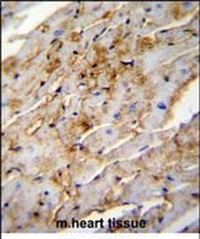 ALDH1L2 Antibody in Immunohistochemistry (Paraffin) (IHC (P))