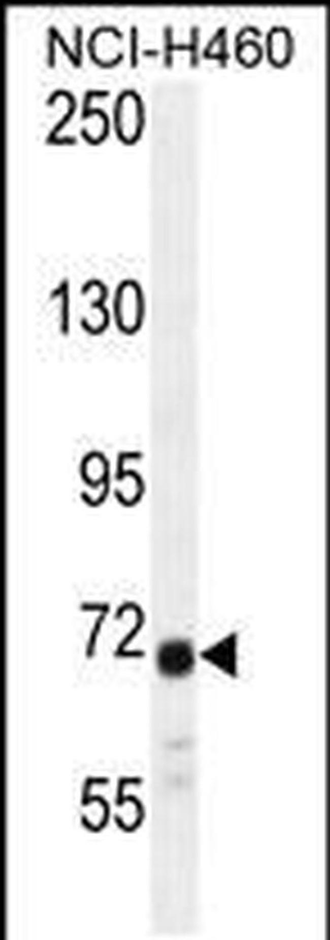 ATXN7L2 Antibody in Western Blot (WB)