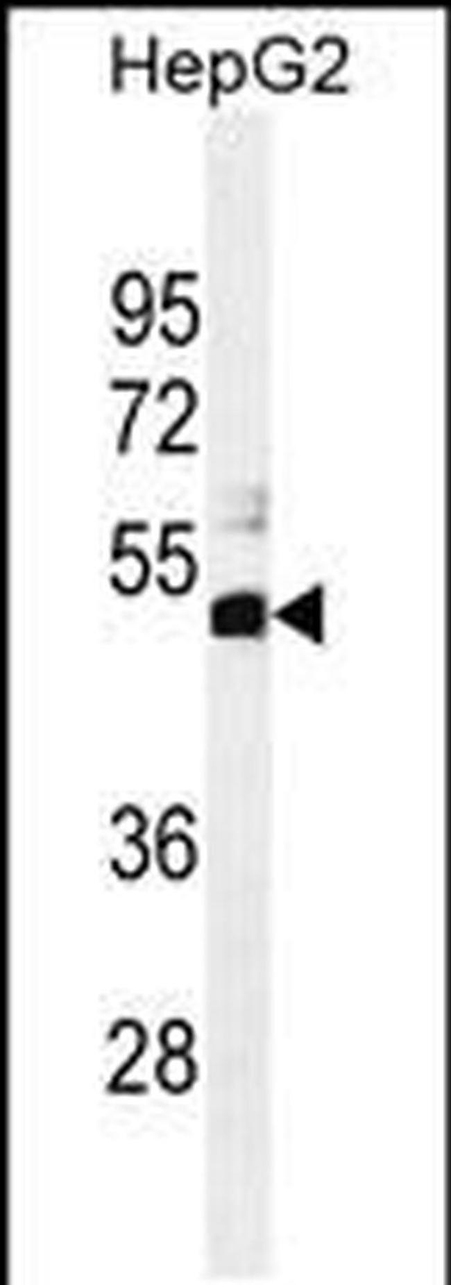 SPDYE1 Antibody in Western Blot (WB)