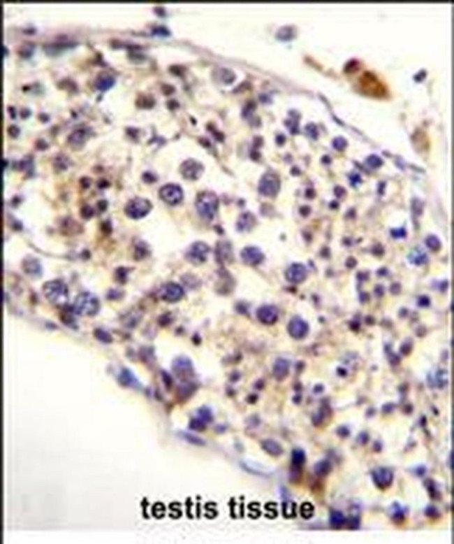 HAUS3 Antibody in Immunohistochemistry (Paraffin) (IHC (P))