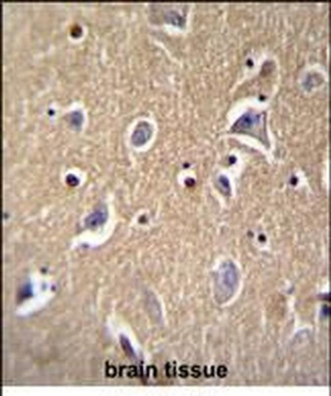 FBXO21 Antibody in Immunohistochemistry (Paraffin) (IHC (P))