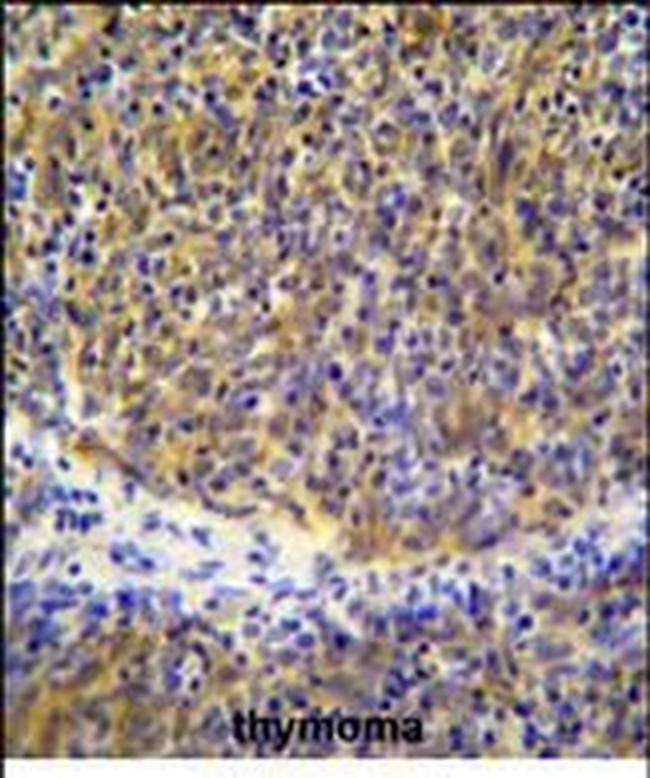 PSMB11 Antibody in Immunohistochemistry (Paraffin) (IHC (P))