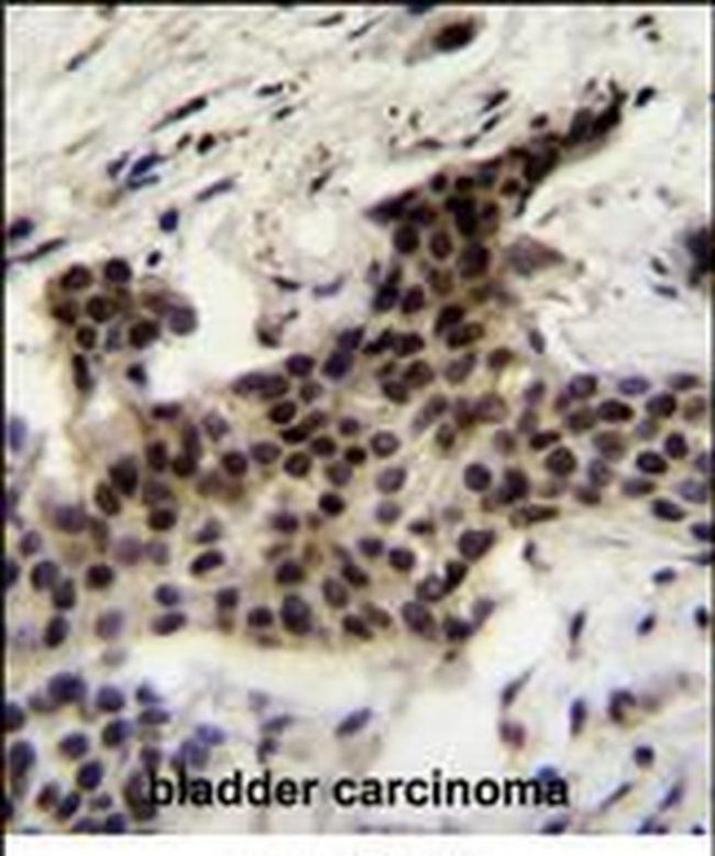 UBXN2A Antibody in Immunohistochemistry (Paraffin) (IHC (P))