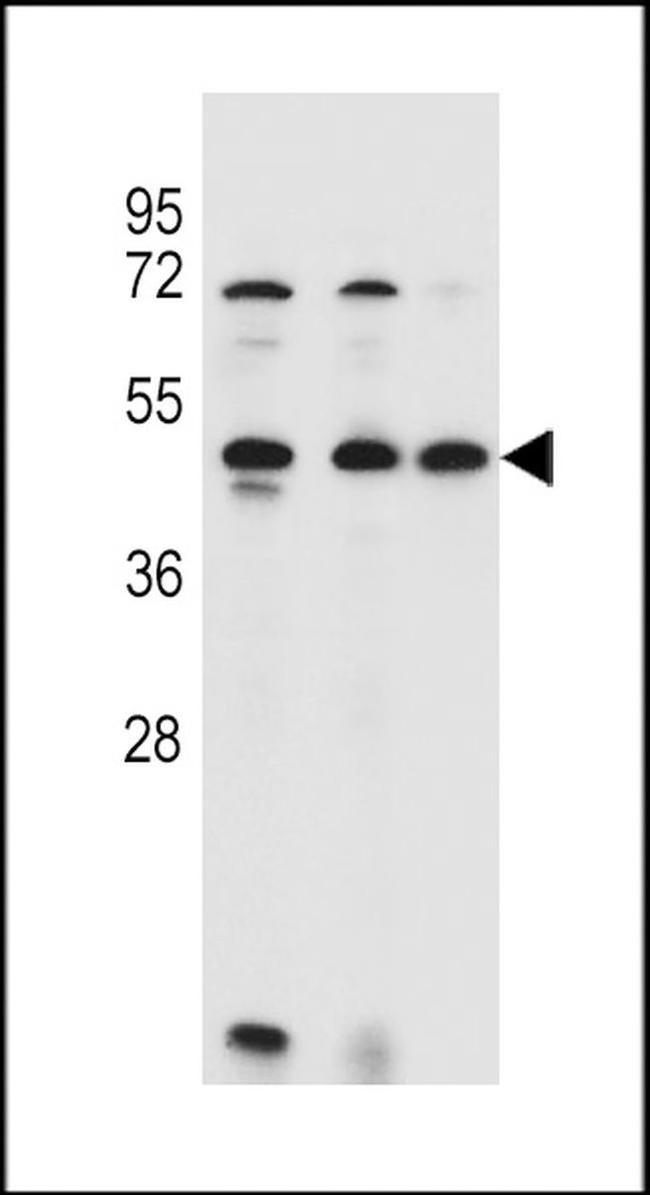 ANKRD40 Antibody in Western Blot (WB)