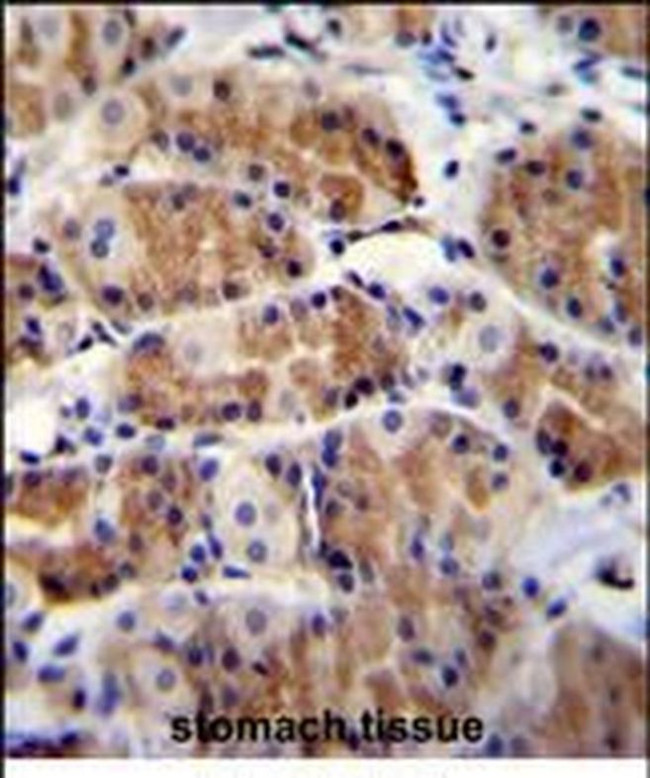 POLR3GL Antibody in Immunohistochemistry (Paraffin) (IHC (P))