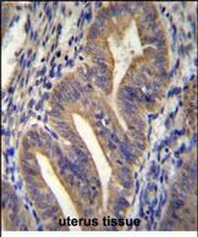 METTL10 Antibody in Immunohistochemistry (Paraffin) (IHC (P))