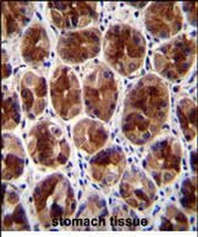 SERTAD4 Antibody in Immunohistochemistry (Paraffin) (IHC (P))