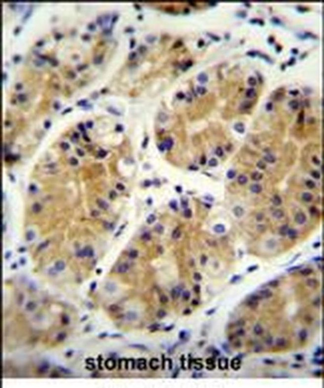 PRR22 Antibody in Immunohistochemistry (Paraffin) (IHC (P))