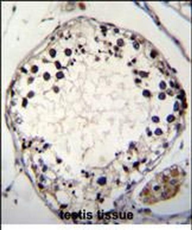 PTCHD3 Antibody in Immunohistochemistry (Paraffin) (IHC (P))
