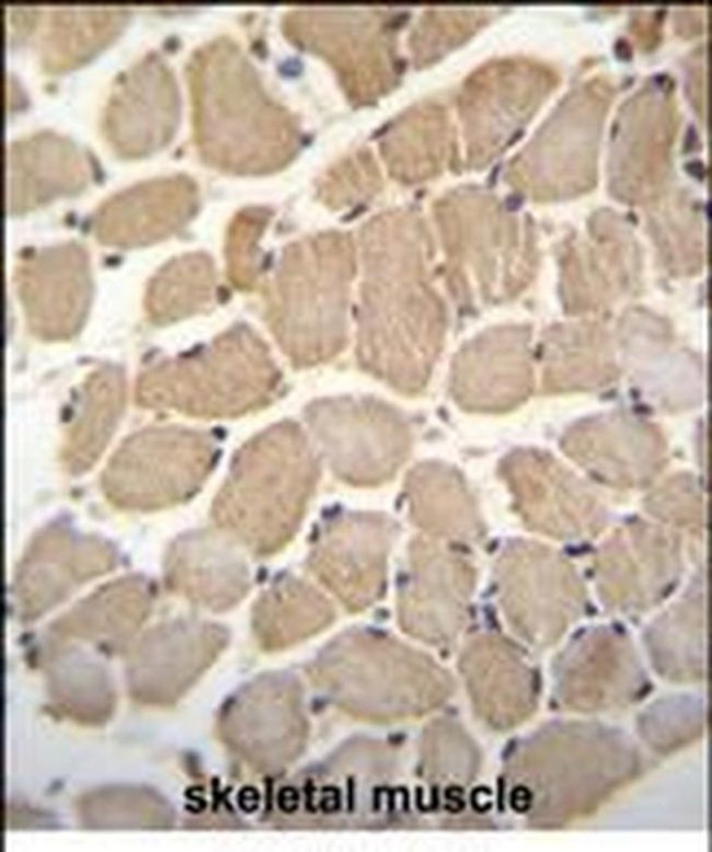 GAS2L2 Antibody in Immunohistochemistry (Paraffin) (IHC (P))
