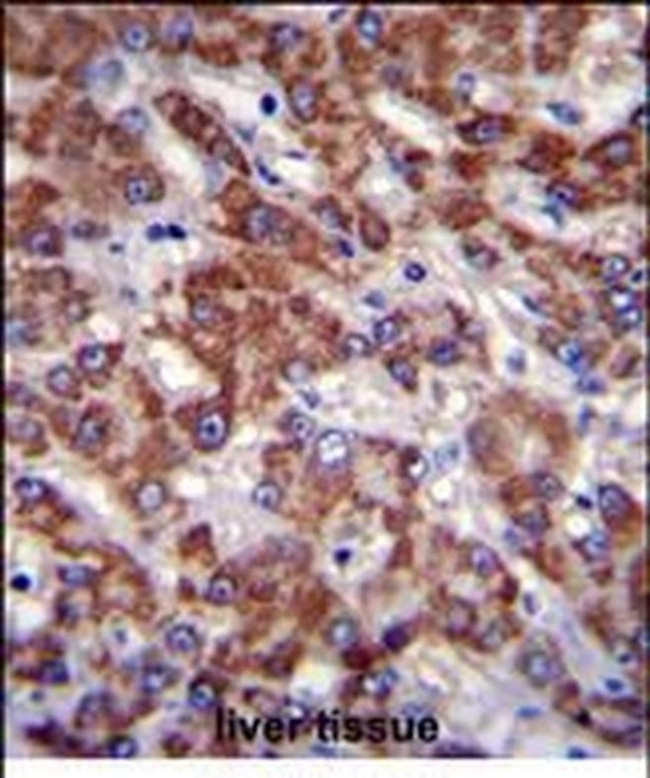 OR2B11 Antibody in Immunohistochemistry (Paraffin) (IHC (P))