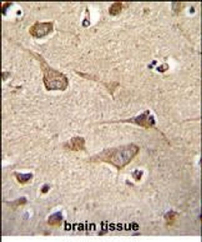KSR2 Antibody in Immunohistochemistry (Paraffin) (IHC (P))