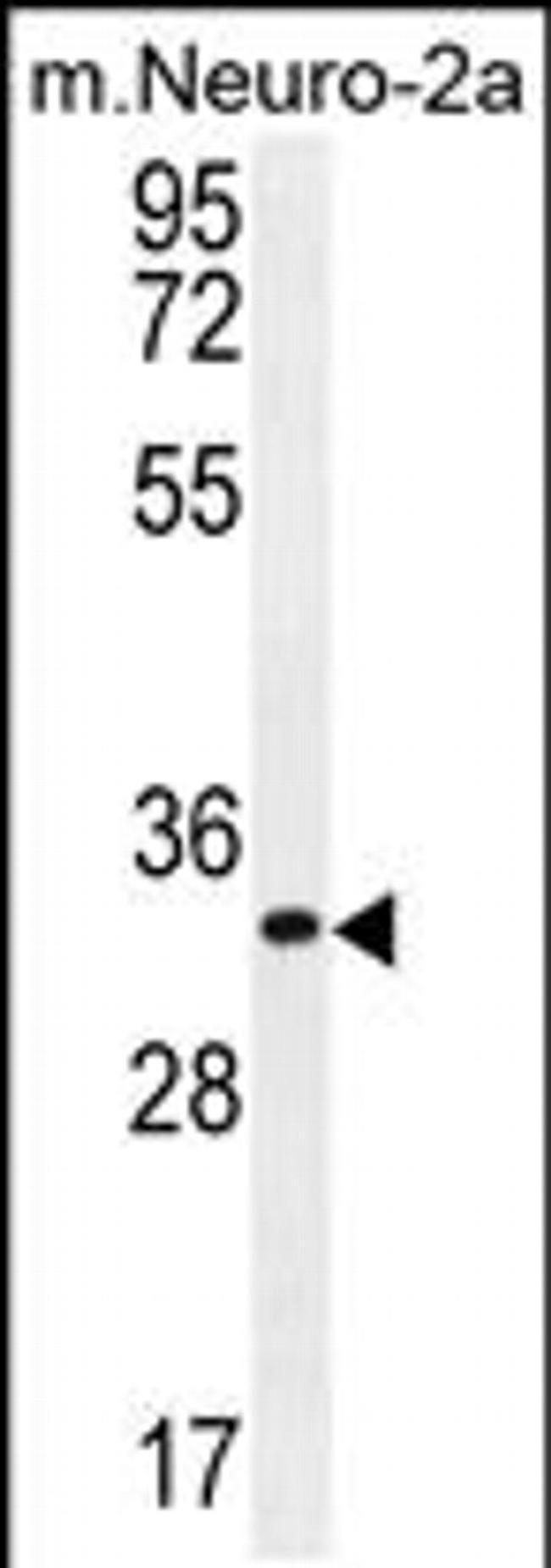 ZC3H8 Antibody in Western Blot (WB)
