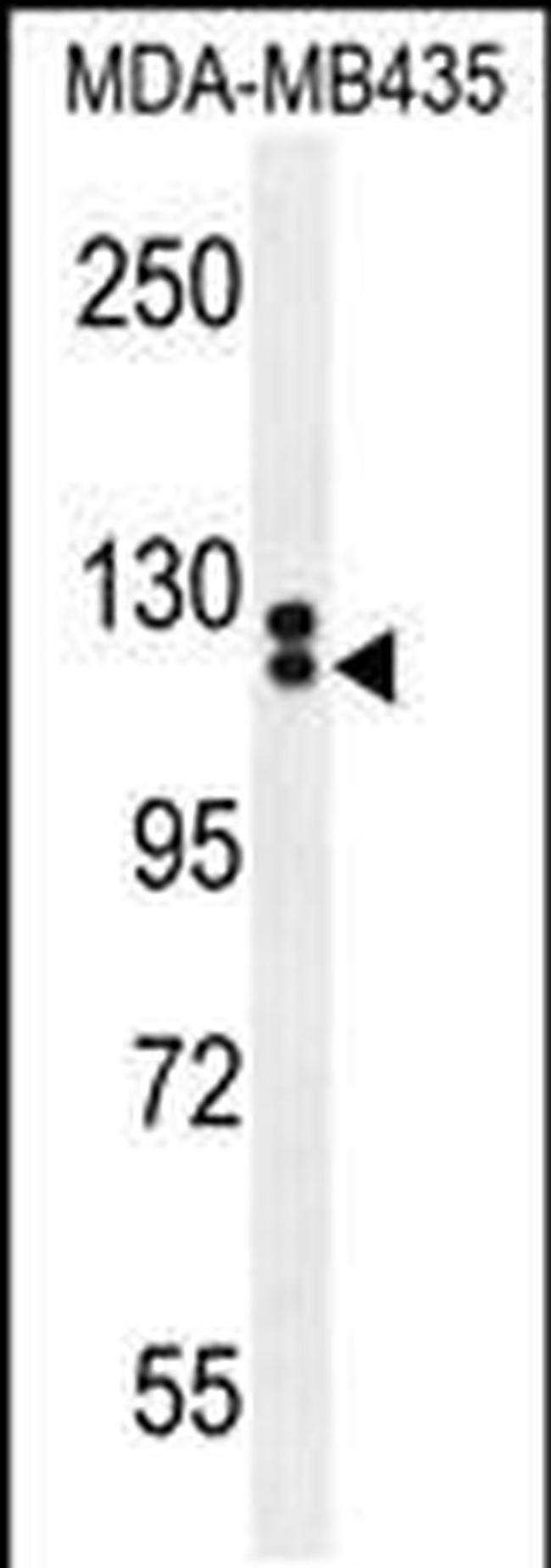 TTLL13 Antibody in Western Blot (WB)