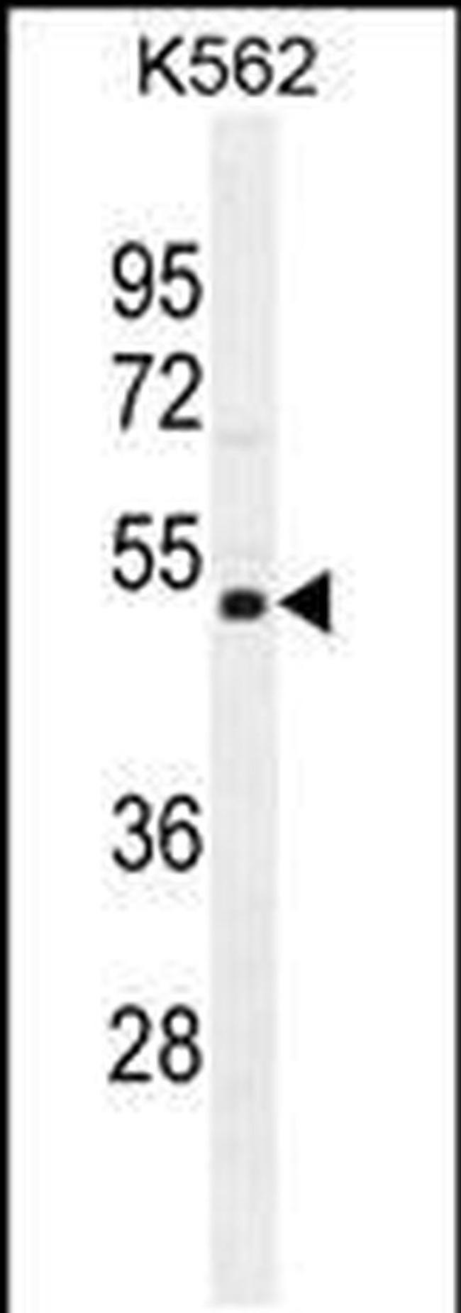 NUDT19 Antibody in Western Blot (WB)