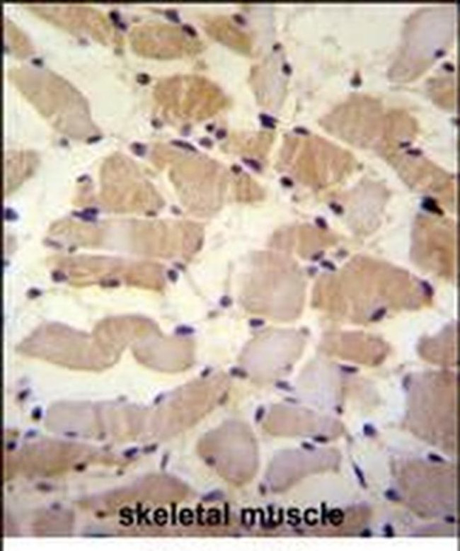SUSD5 Antibody in Immunohistochemistry (Paraffin) (IHC (P))