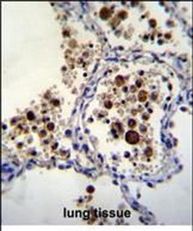 SIGLEC15 Antibody in Immunohistochemistry (Paraffin) (IHC (P))