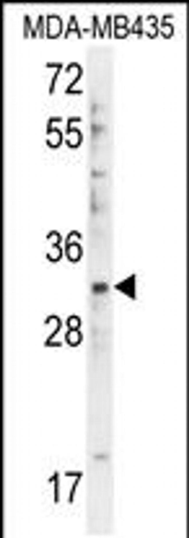 DTWD1 Antibody in Western Blot (WB)