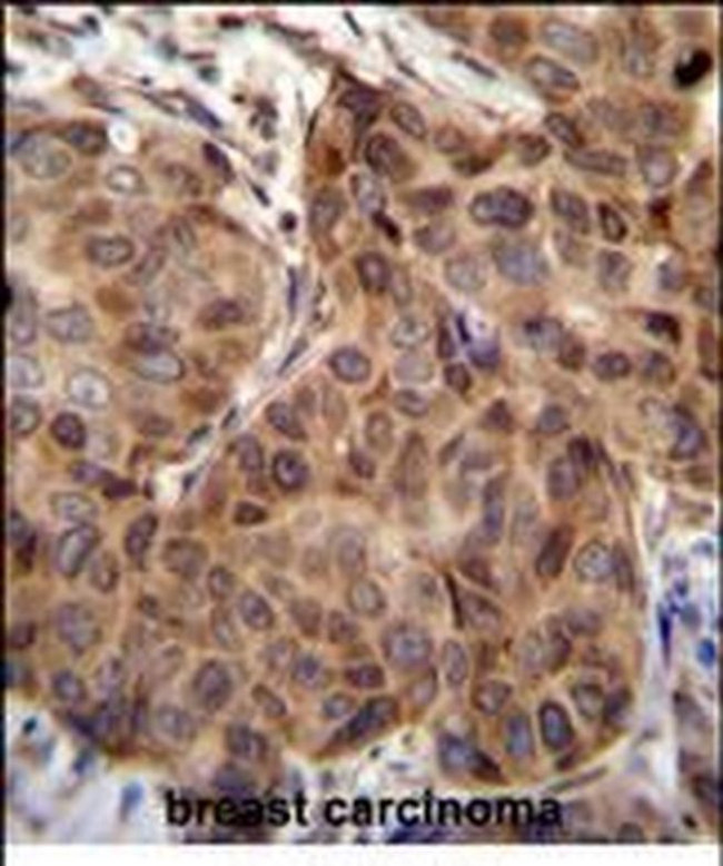 SNX24 Antibody in Immunohistochemistry (Paraffin) (IHC (P))