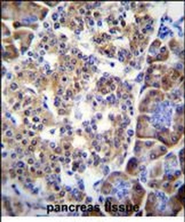 SMYD4 Antibody in Immunohistochemistry (Paraffin) (IHC (P))