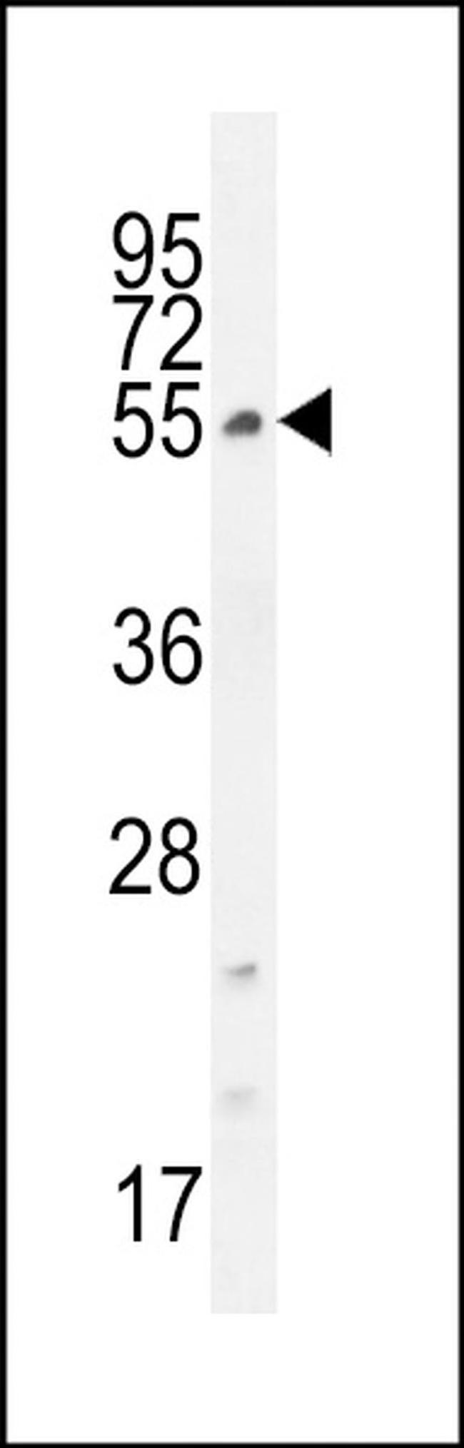 CCDC61 Antibody in Western Blot (WB)