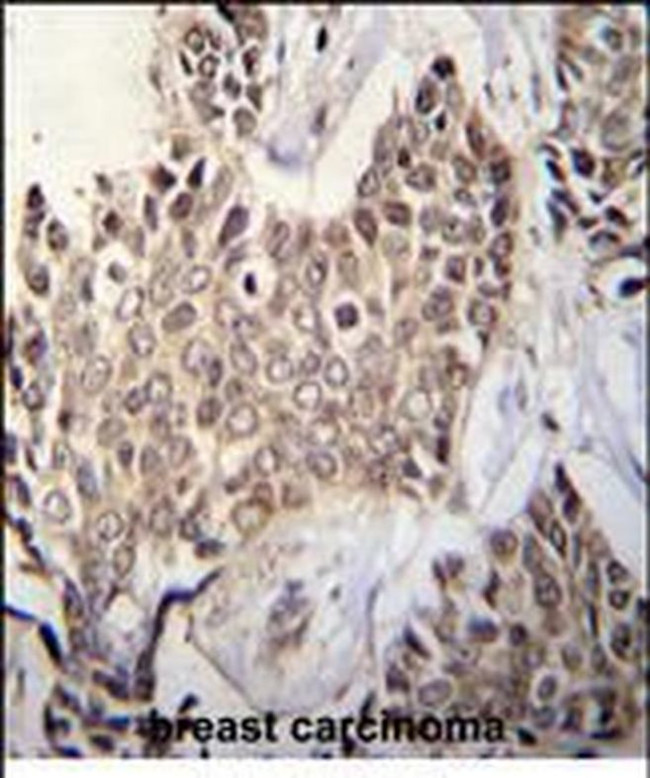 ZBTB42 Antibody in Immunohistochemistry (Paraffin) (IHC (P))