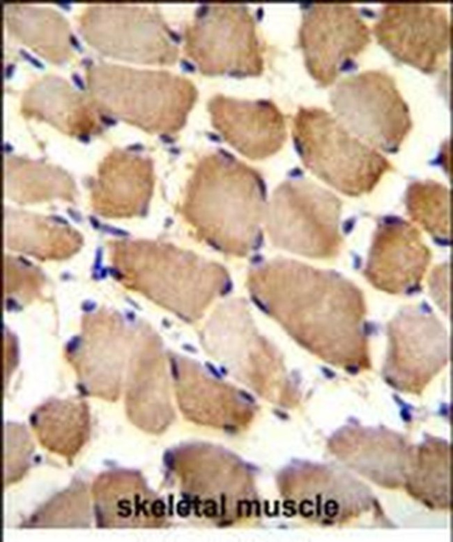 ARL17A Antibody in Immunohistochemistry (Paraffin) (IHC (P))