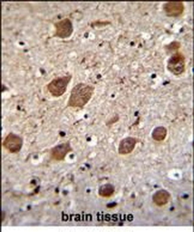 KCTD8 Antibody in Immunohistochemistry (Paraffin) (IHC (P))
