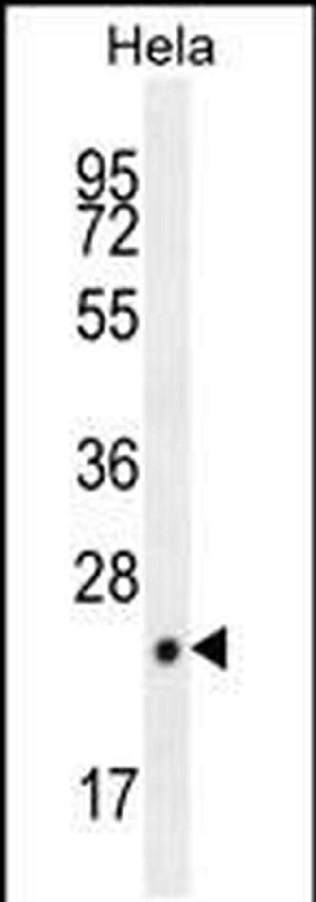 CPSF4L Antibody in Western Blot (WB)