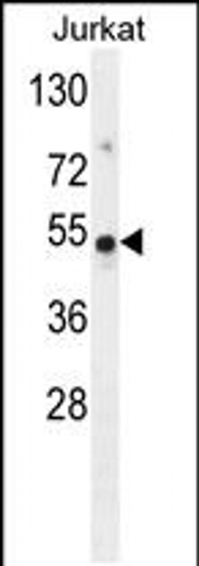 FAM118B Antibody in Western Blot (WB)