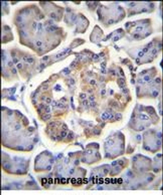 BTBD17 Antibody in Immunohistochemistry (Paraffin) (IHC (P))