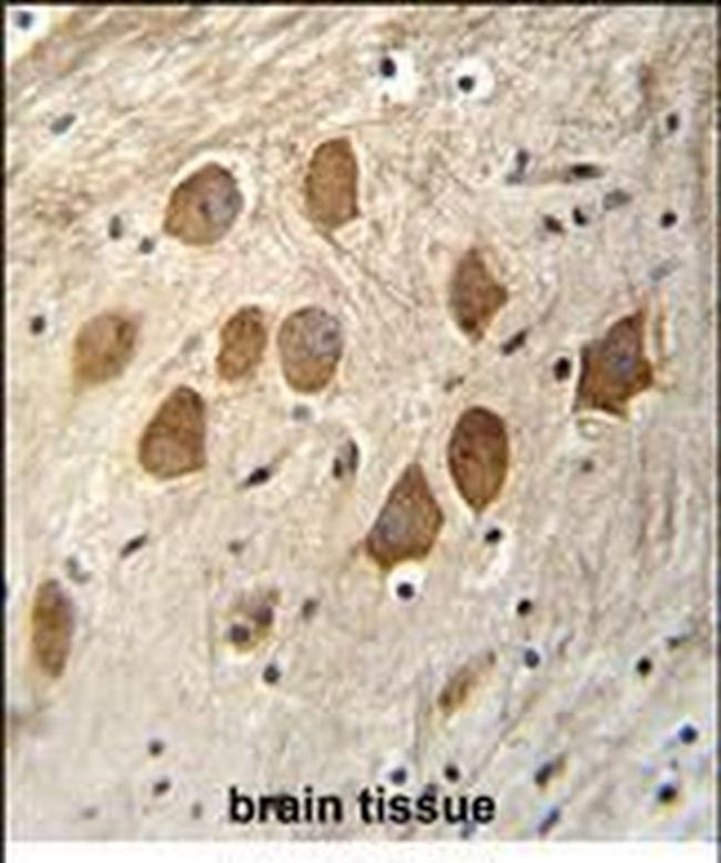 HCFC1R1 Antibody in Immunohistochemistry (Paraffin) (IHC (P))
