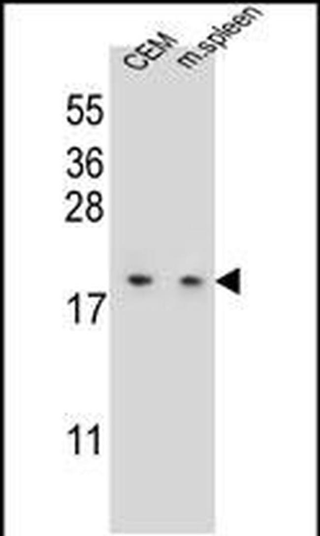 LSM7 Antibody in Western Blot (WB)