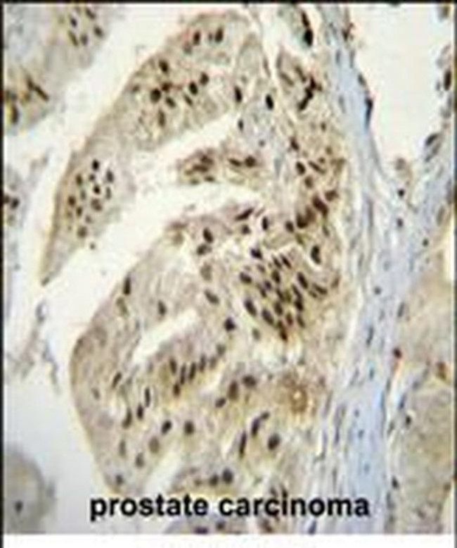 PAPOLA Antibody in Immunohistochemistry (Paraffin) (IHC (P))