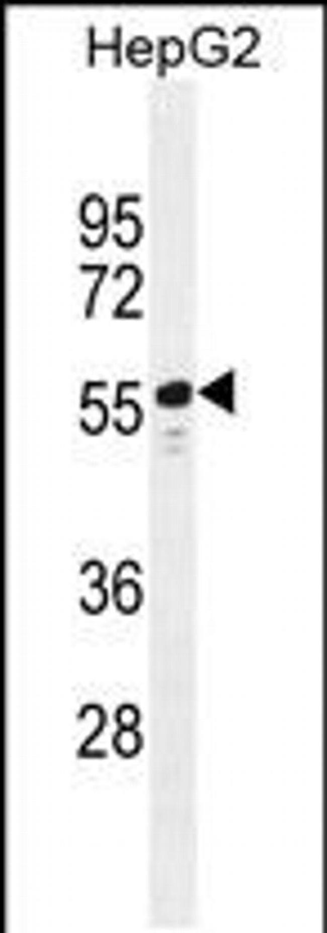 TTC6 Antibody in Western Blot (WB)