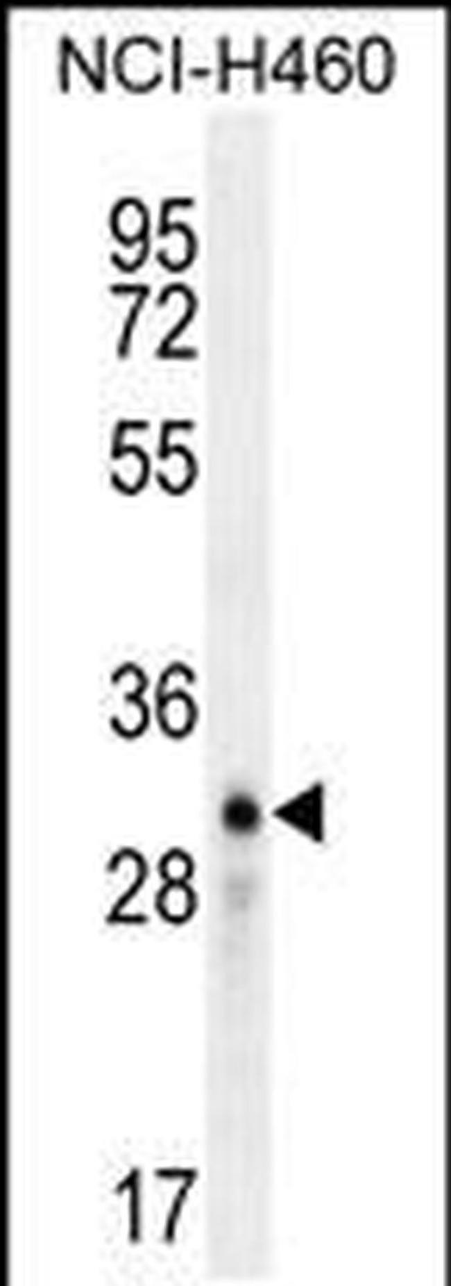 LCN9 Antibody in Western Blot (WB)
