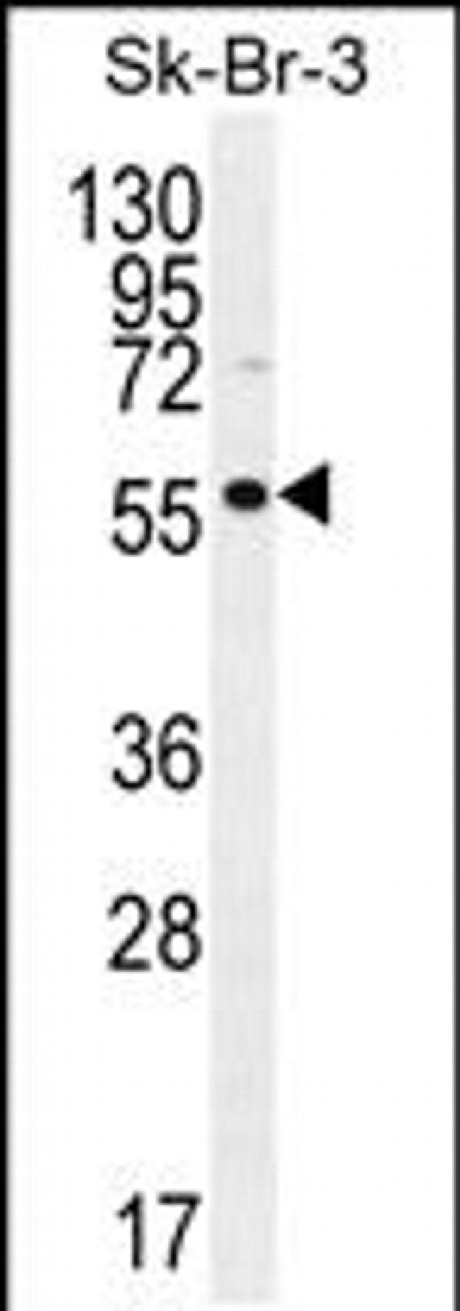 TRABD2A Antibody in Western Blot (WB)