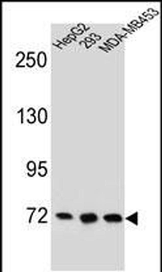 ZNF860 Antibody in Western Blot (WB)