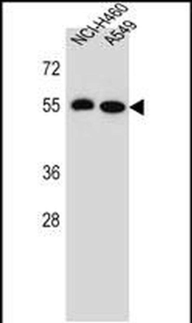 LRRC6 Antibody in Western Blot (WB)