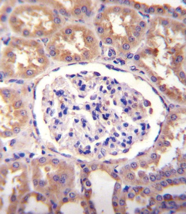 SLCO4C1 Antibody in Immunohistochemistry (Paraffin) (IHC (P))