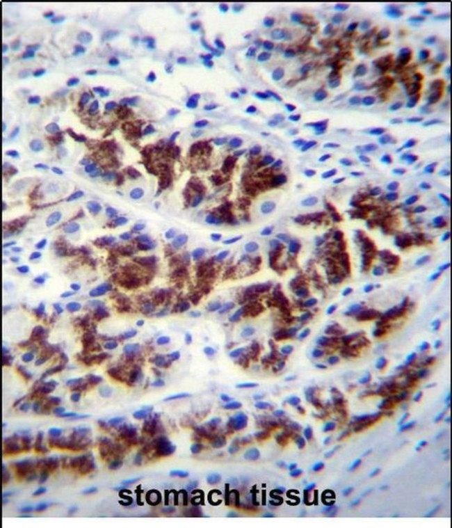 PTPN20A Antibody in Immunohistochemistry (Paraffin) (IHC (P))