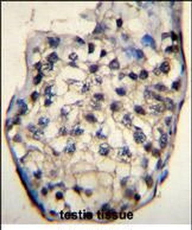 ODF3 Antibody in Immunohistochemistry (Paraffin) (IHC (P))