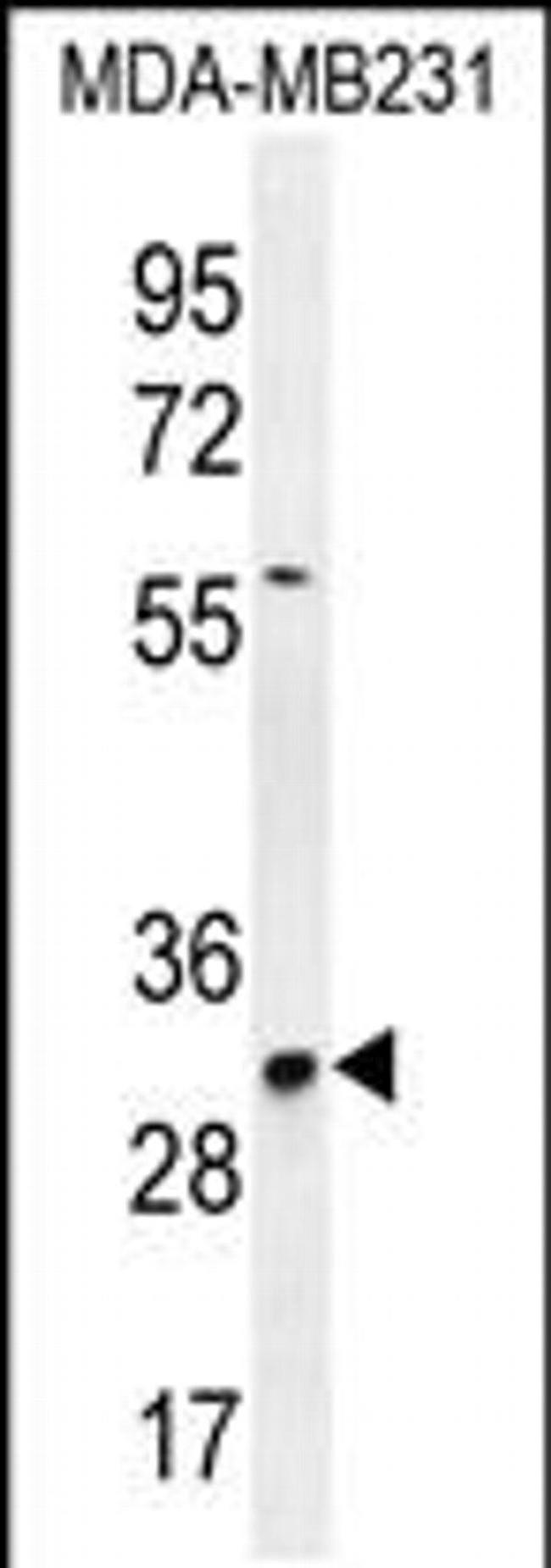 TNFAIP8L3 Antibody in Western Blot (WB)