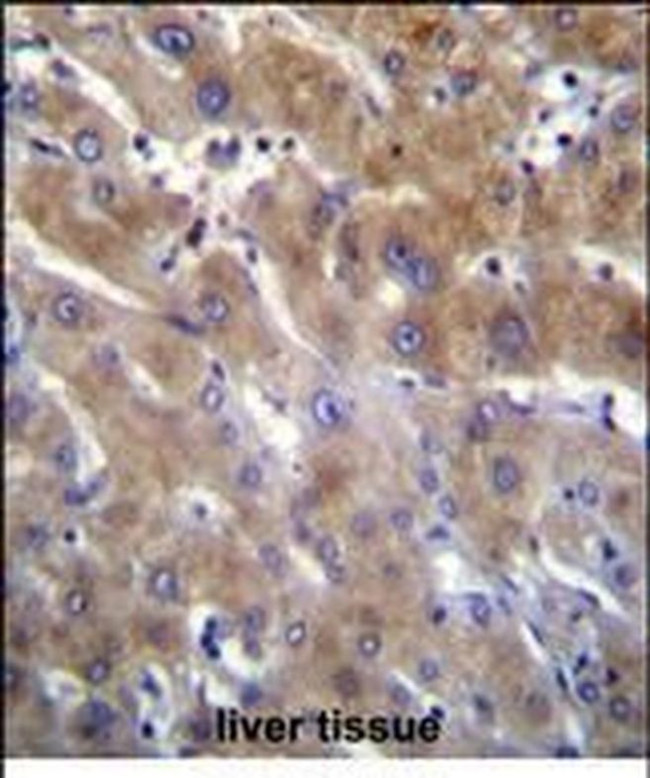 ANKRD18B Antibody in Immunohistochemistry (Paraffin) (IHC (P))
