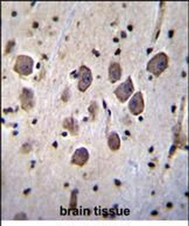 ANKRD34C Antibody in Immunohistochemistry (Paraffin) (IHC (P))